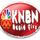 [USA] NBC 21 RAPID CITY SD (KNBN) logo